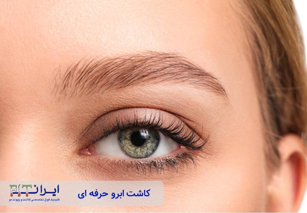 کاشت ابرو حرفه ای