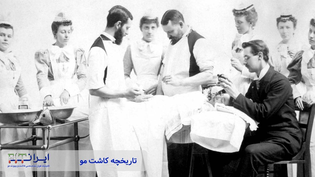 تاریخچه کاشت مو