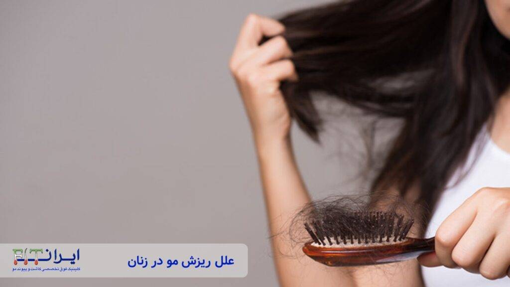 علل ریزش مو زنان