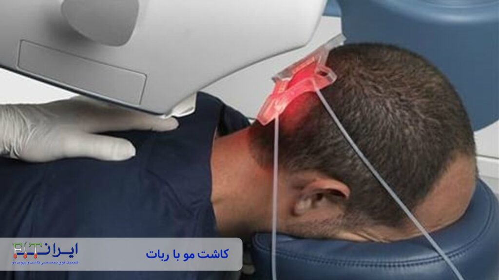 کاشت مو با ربات