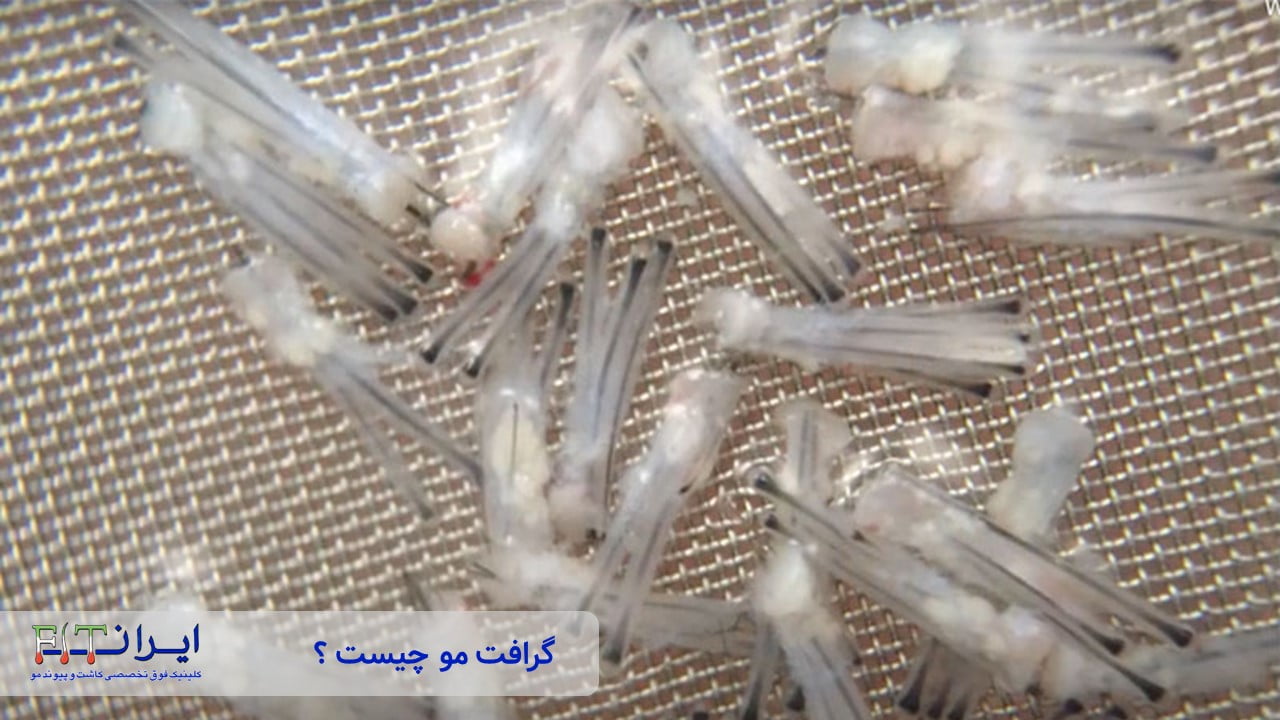 گرافت مو چیست ؟